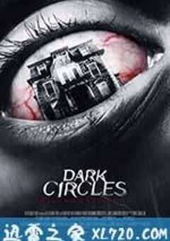 黑眼圈